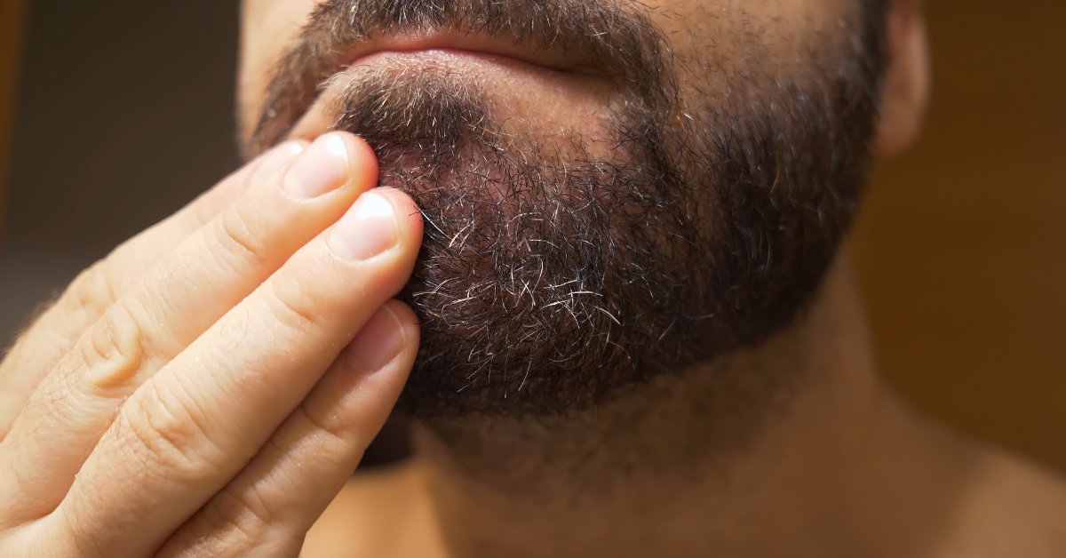 Stop Beard Itch Now How to Treat Dry Skin Under Beard That Actually Works